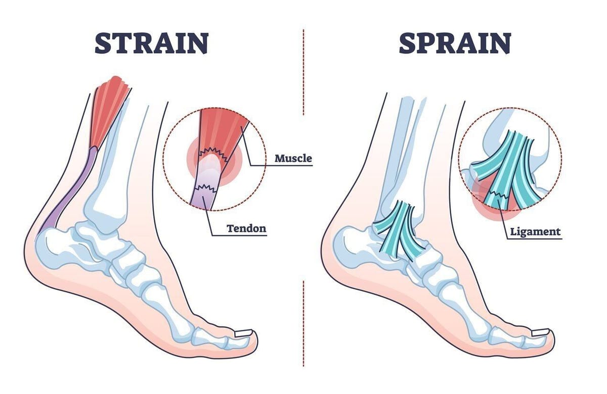 Tendons & Ligaments - the forgotten aspect of training