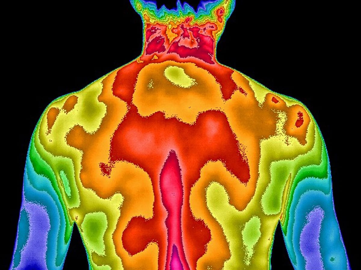 Thermography - what is it?