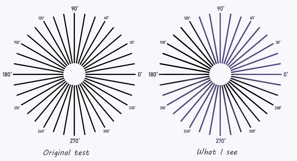 Astigmatism: what is it?