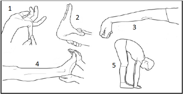 Ligament Laxity - is this why your joints hurt?